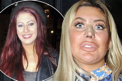 chloe geordie shore weight loss|Chloe Ferry shares before and after snaps after 2 stone weight loss.